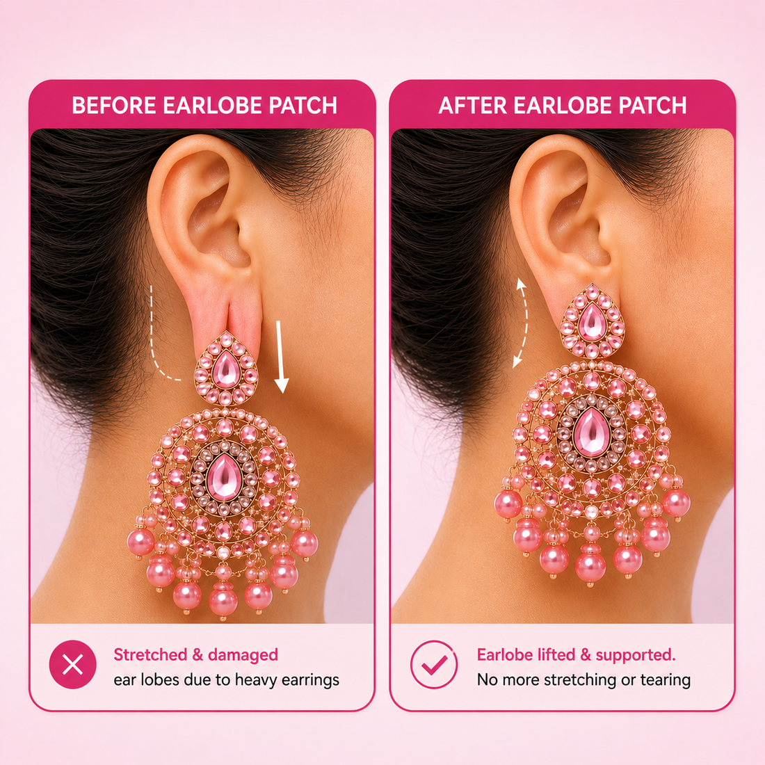 Premium Earlobe Support Patches (100 Pcs) | Invisible Lift & Support for Heavy Earrings